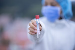Bucurestenii  asimptomatici  se pot  înscrie  ca  voluntari pentru testarea  cu  teste PCR