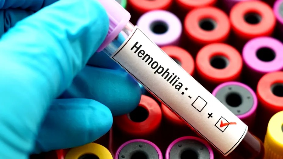 Ziua Mondială de Conștientizare a Hemofiliei