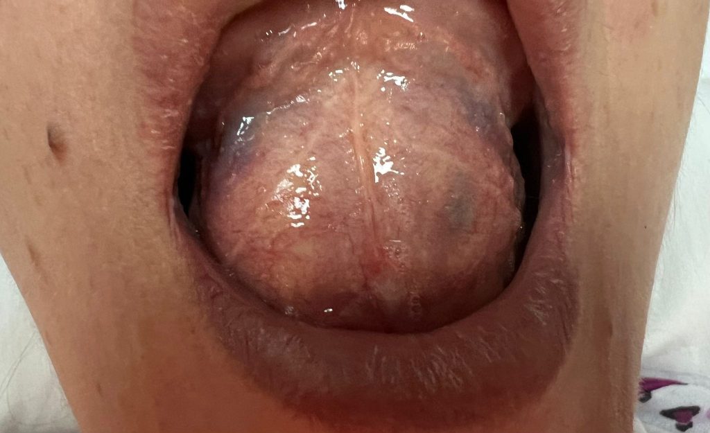 echipa secţiei Chirurgie orală și maxilo-facială